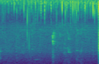 A blue and green spectrogram of a heartbeat.